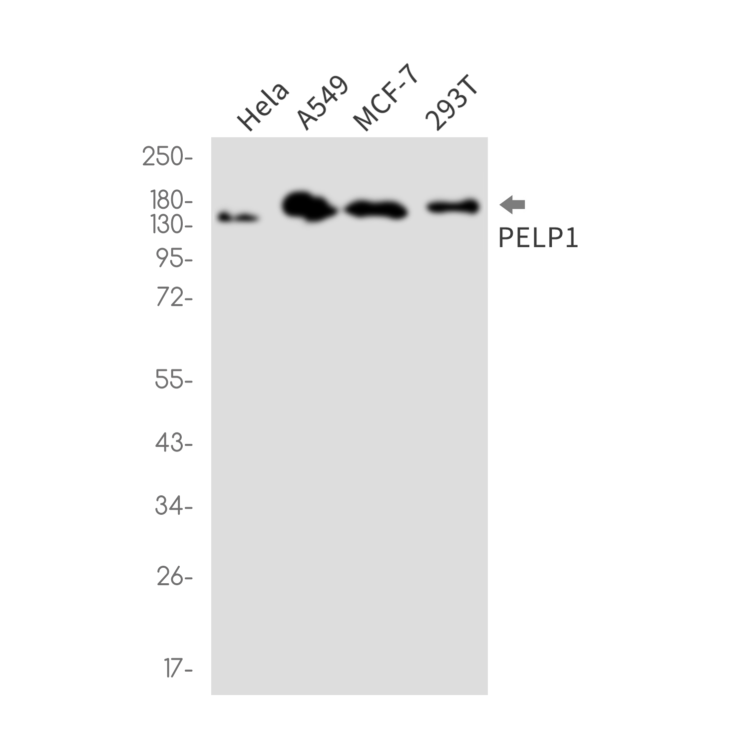 PELP1 Rabbit mAb ABZ1996