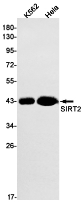 SIRT2 Rabbit mAb ABZ1999