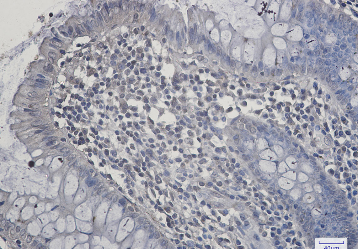 SIRT2 Rabbit mAb ABZ2000