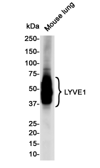 LYVE1 Rabbit mAb ABZ2004