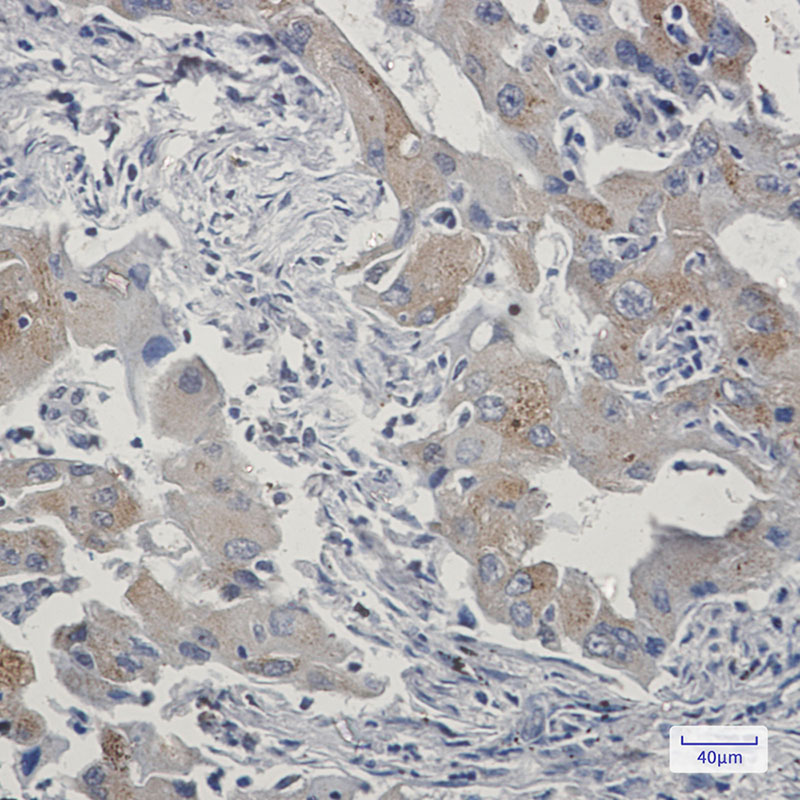 TAX1BP1 Rabbit mAb ABZ2008