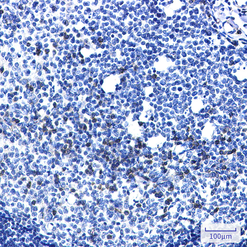 LYRIC/AEG1 Rabbit mAb ABZ2011
