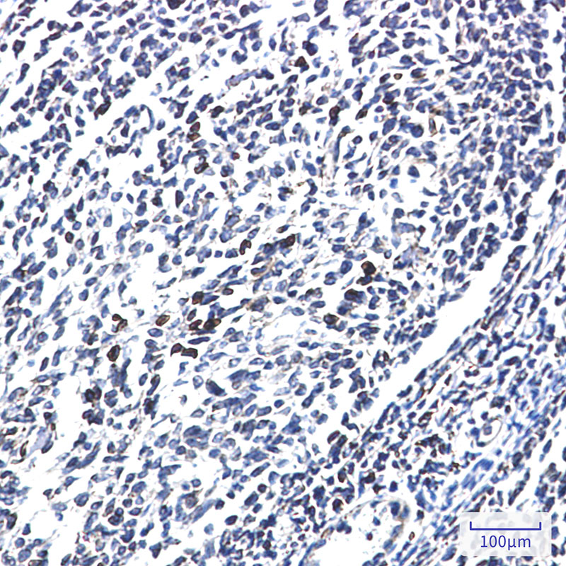 LYRIC/AEG1 Rabbit mAb ABZ2012