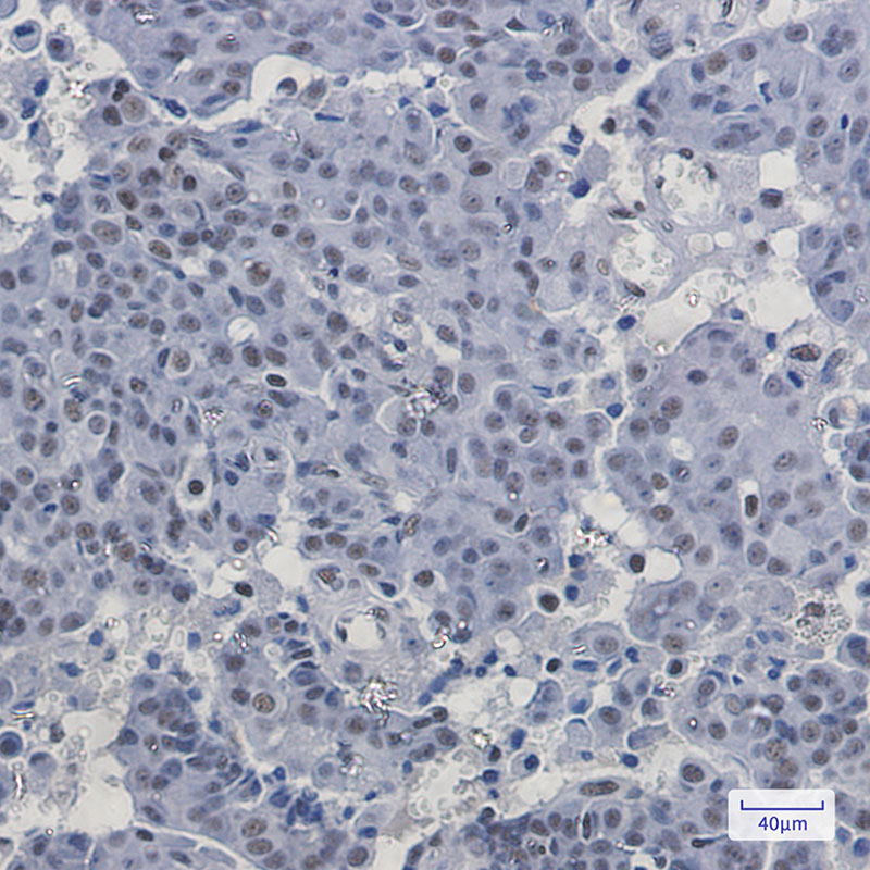 PABPN1 Rabbit mAb ABZ2013