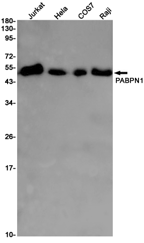 PABPN1 Rabbit mAb ABZ2013