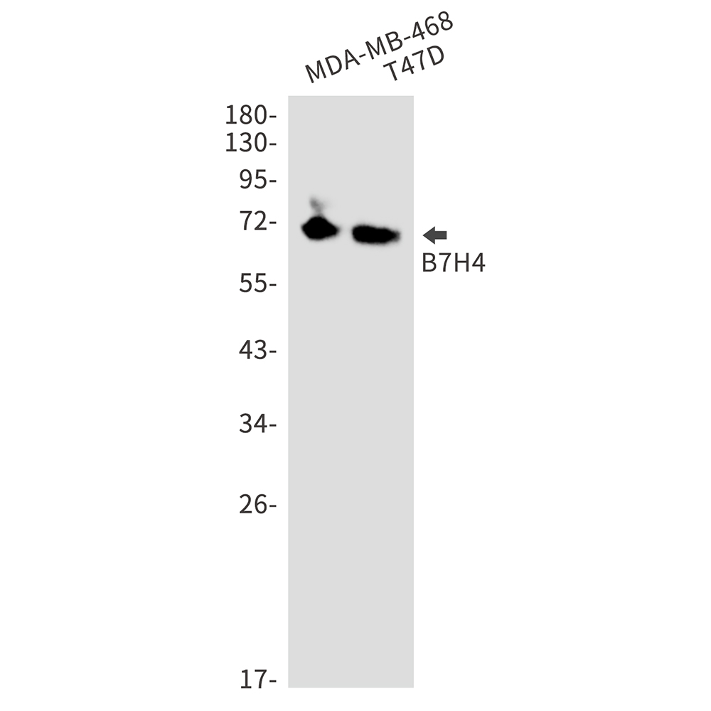 B7H4 Rabbit mAb ABZ2014