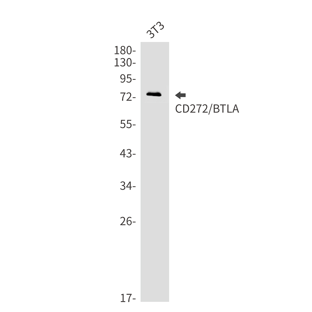 CD272/BTLA Rabbit mAb ABZ2016