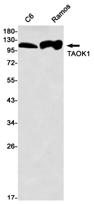 TAOK1 Rabbit mAb ABZ2017