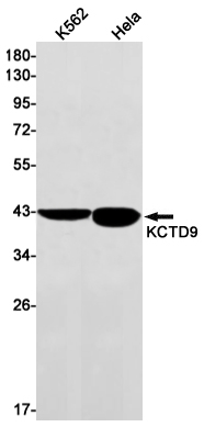 KCTD9 Rabbit mAb ABZ2019