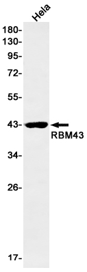 RBM43 Rabbit mAb ABZ2020