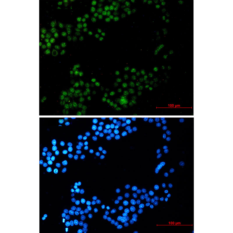 CRTC3 Rabbit mAb ABZ2022