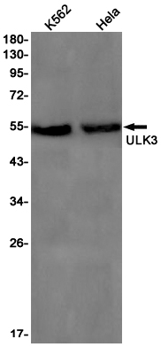 ULK3 Rabbit mAb ABZ2024