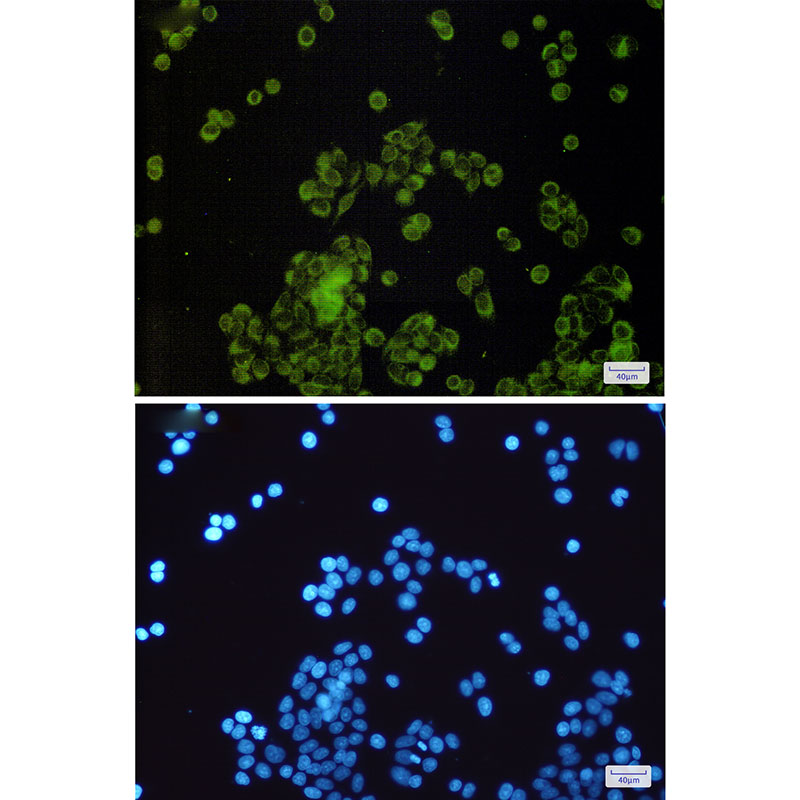 SLC27A4 / FATP4 Rabbit mAb ABZ2025