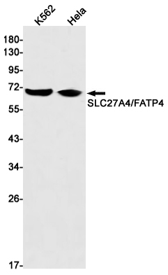 SLC27A4 / FATP4 Rabbit mAb ABZ2025