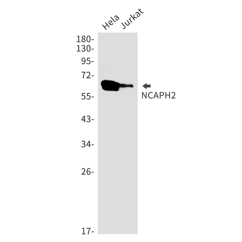 NCAPH2 Rabbit mAb ABZ2028