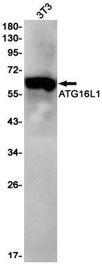 ATG16L1 Rabbit mAb ABZ2030