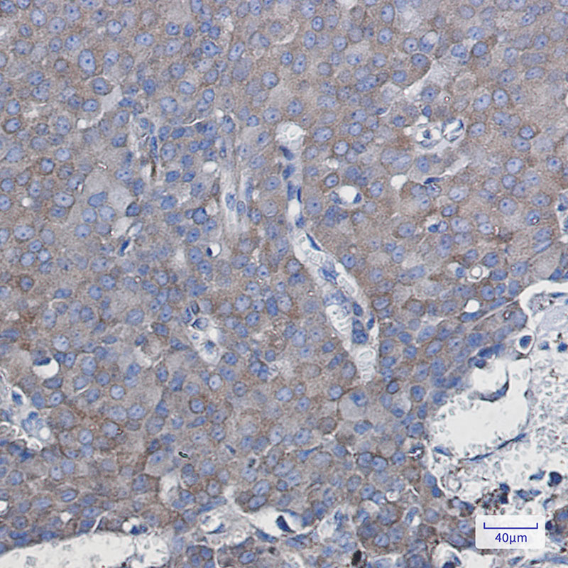 NDUFAF5 Rabbit mAb ABZ2036