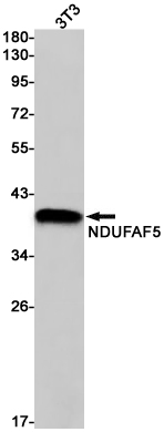 NDUFAF5 Rabbit mAb ABZ2036