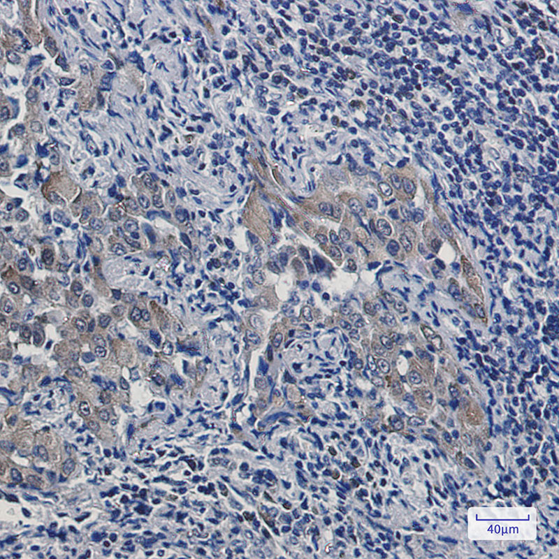 Artemin Rabbit mAb ABZ2037
