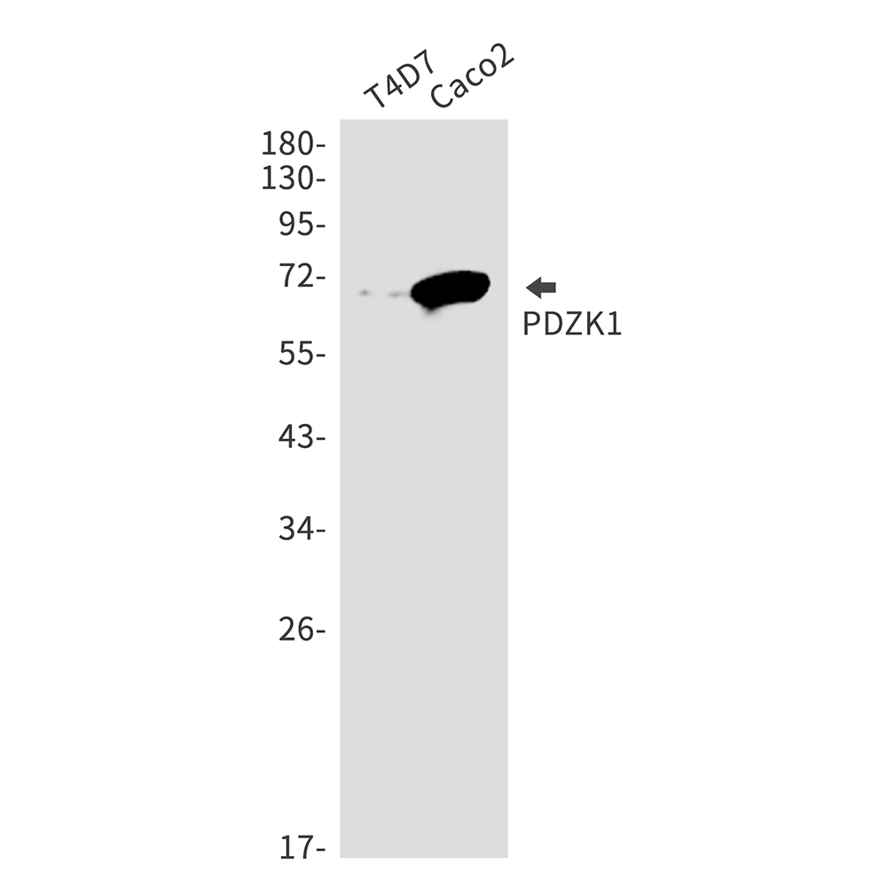 PDZK1 Rabbit mAb ABZ2038