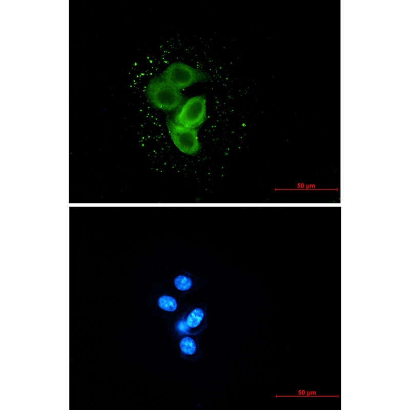 Meckelin Rabbit mAb ABZ2044