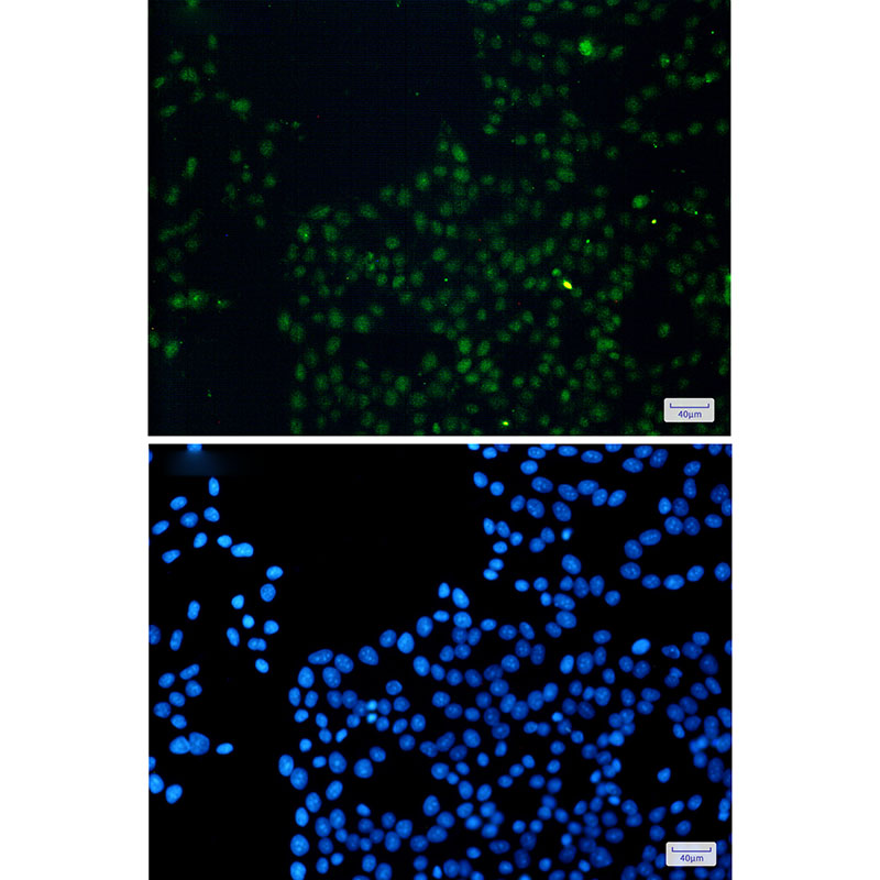 FAM98B Rabbit mAb ABZ2045