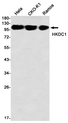HKDC1 Rabbit mAb ABZ2048