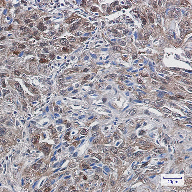 TXNRD1 Rabbit mAb ABZ2051