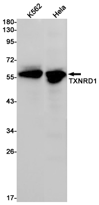 TXNRD1 Rabbit mAb ABZ2051