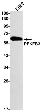 PFKFB3 Rabbit mAb ABZ2052