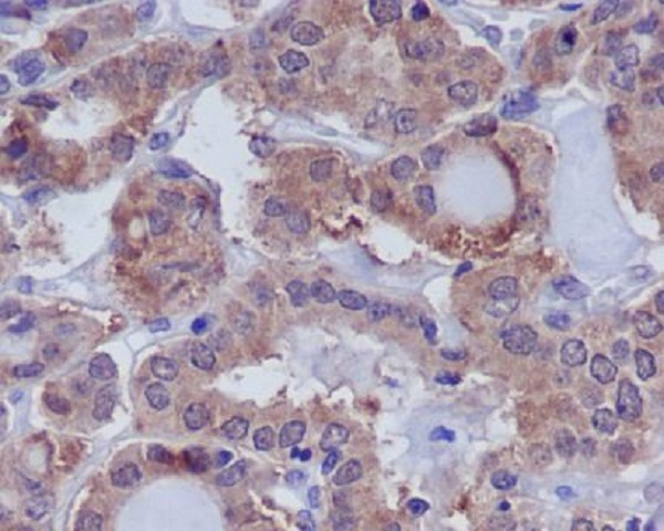 DUSP6 Rabbit mAb ABZ2053