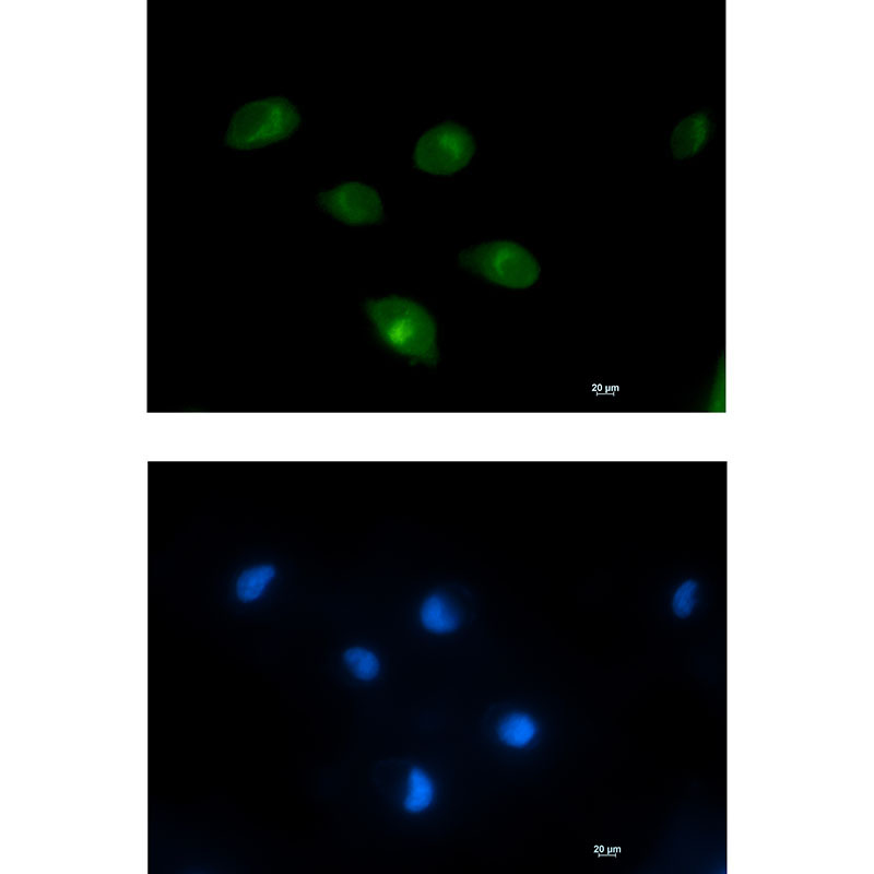 PCK2 Rabbit mAb ABZ2054