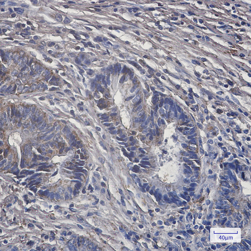 PCK2 Rabbit mAb ABZ2054
