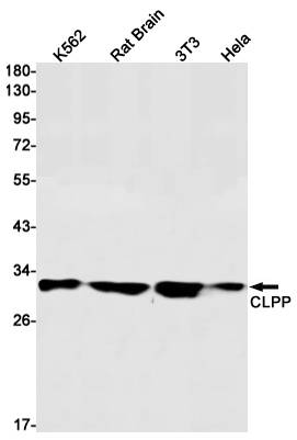 CLPP Rabbit mAb ABZ2056