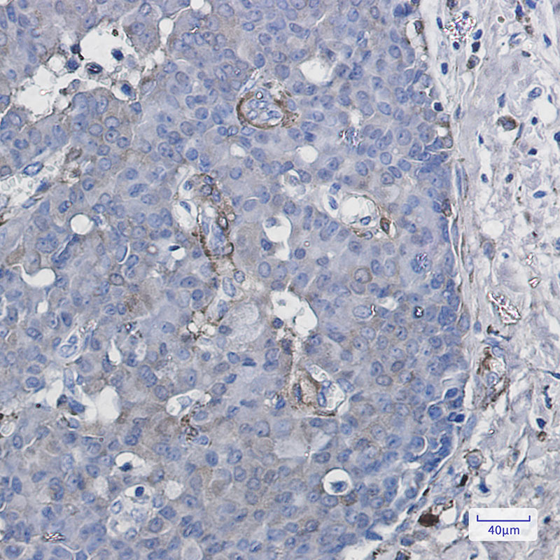 CYP1B1 Rabbit mAb ABZ2057