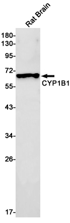 CYP1B1 Rabbit mAb ABZ2057