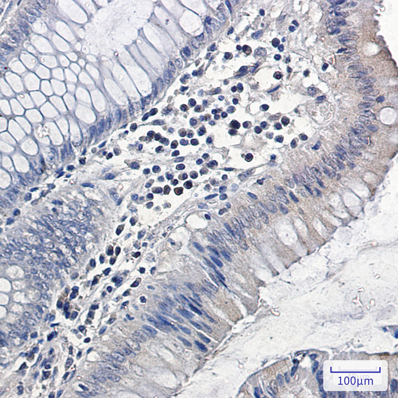 MAPK6 Rabbit mAb ABZ2058
