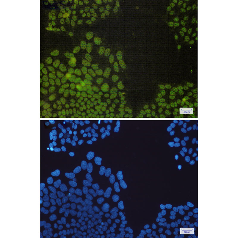 NRF1 Rabbit mAb ABZ2059