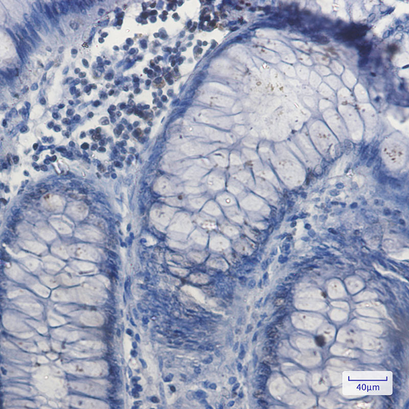 NRF1 Rabbit mAb ABZ2059