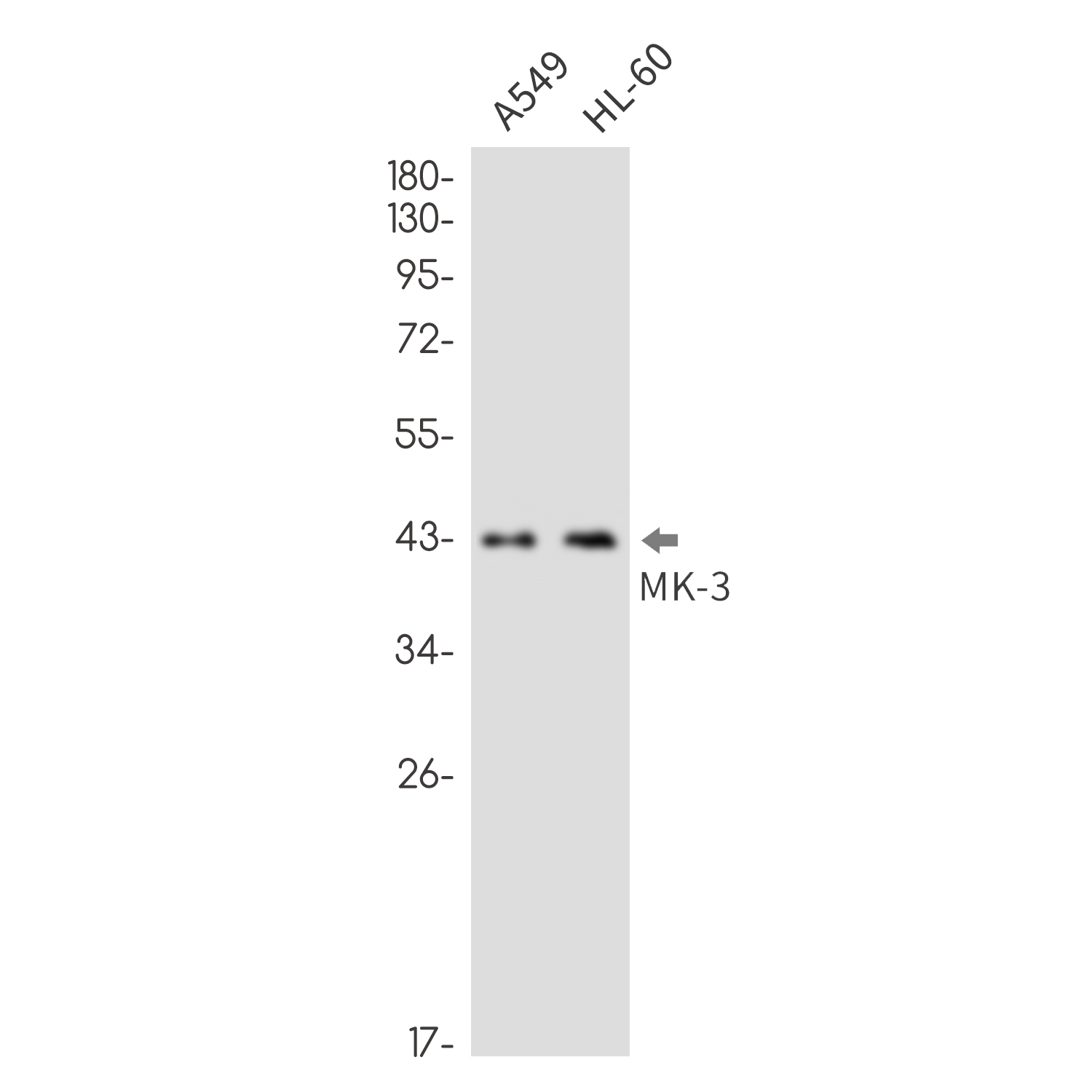 MAPKAPK3 Rabbit mAb ABZ2061