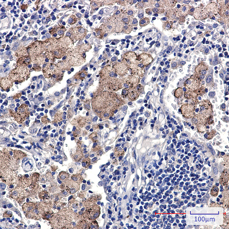 SMN/Gemin 1 Rabbit mAb ABZ2062