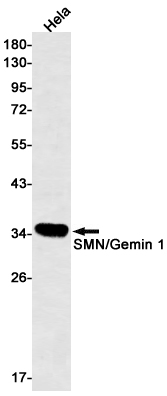 SMN/Gemin 1 Rabbit mAb ABZ2062