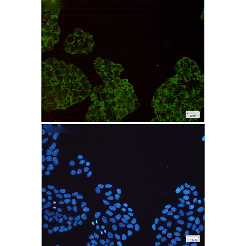SMN/Gemin 1 Rabbit mAb ABZ2063