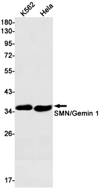 SMN/Gemin 1 Rabbit mAb ABZ2063