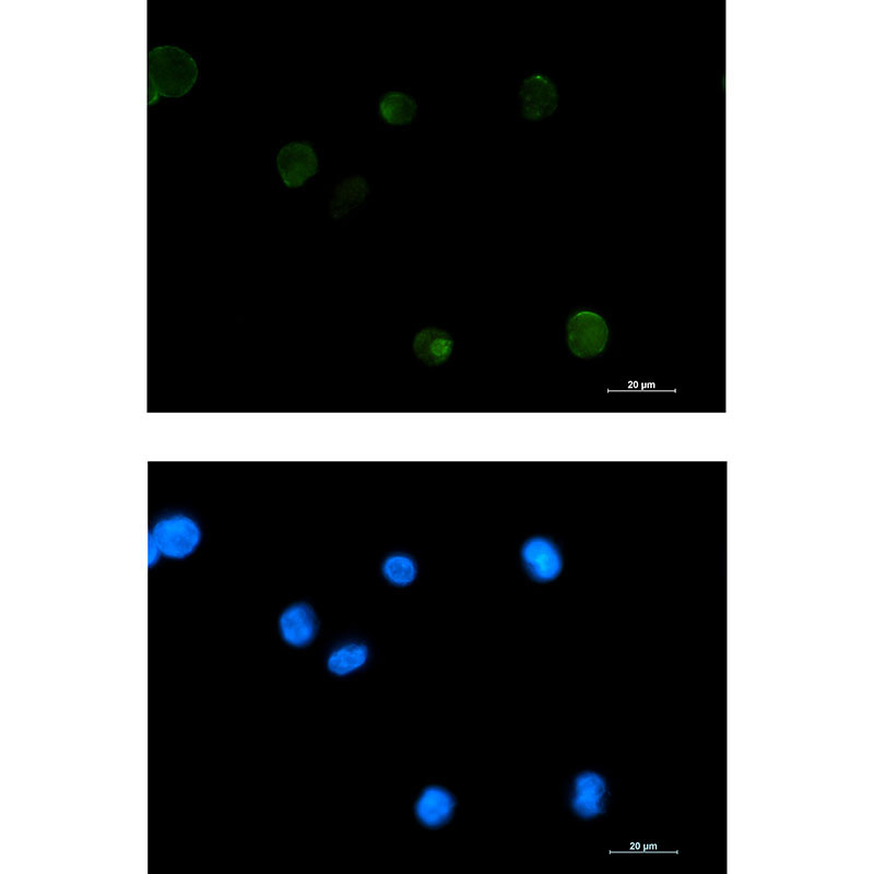 Extracellular Matrix Protein 1 Rabbit mAb ABZ2066
