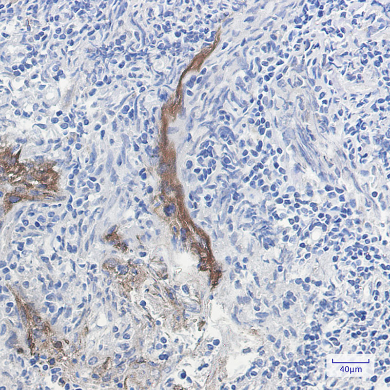 Extracellular Matrix Protein 1 Rabbit mAb ABZ2066