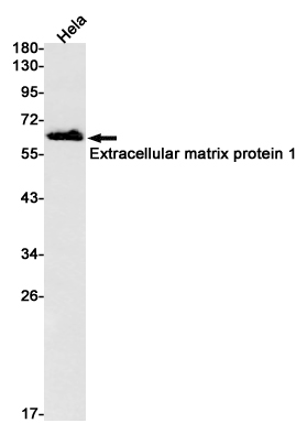 Extracellular Matrix Protein 1 Rabbit mAb ABZ2066