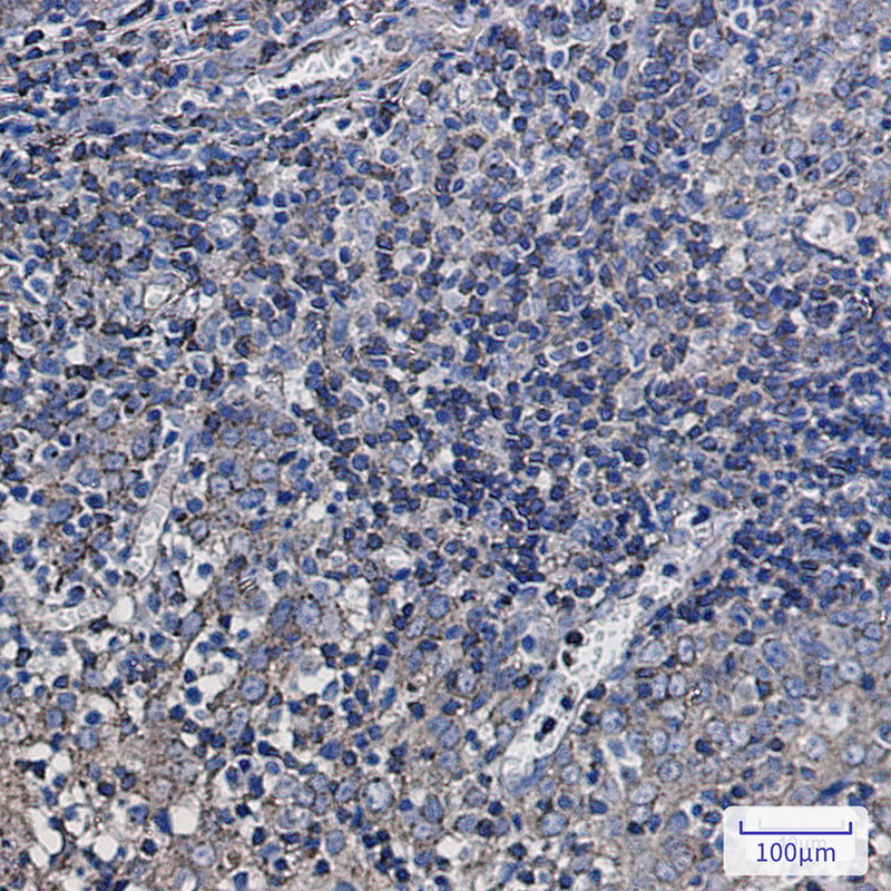 Synaptophysin Like Protein 1 Rabbit mAb ABZ2068