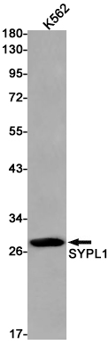 Synaptophysin Like Protein 1 Rabbit mAb ABZ2068