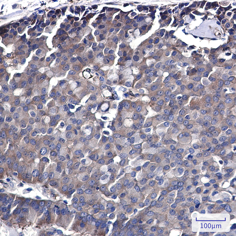 CDC37 Rabbit mAb ABZ2070